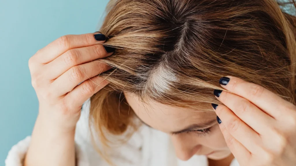 Dile adiós a las canas amarillas.